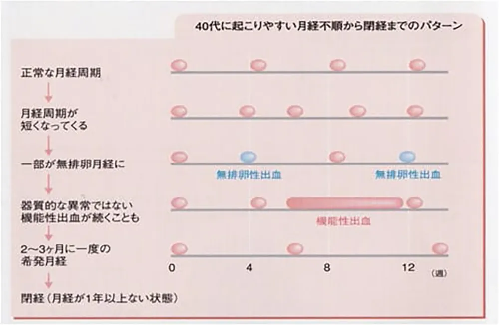 40代に起こりやすい月経不順から閉経までのパターン