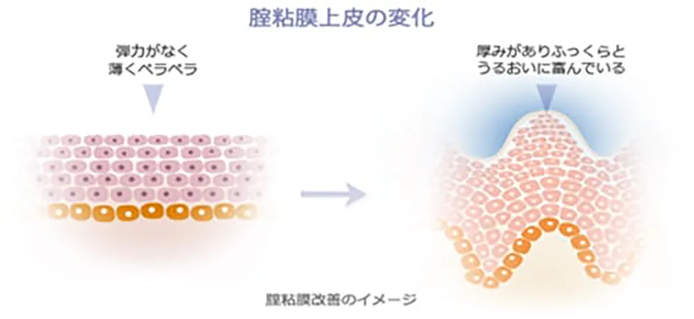 膣粘膜改善のイメージ図